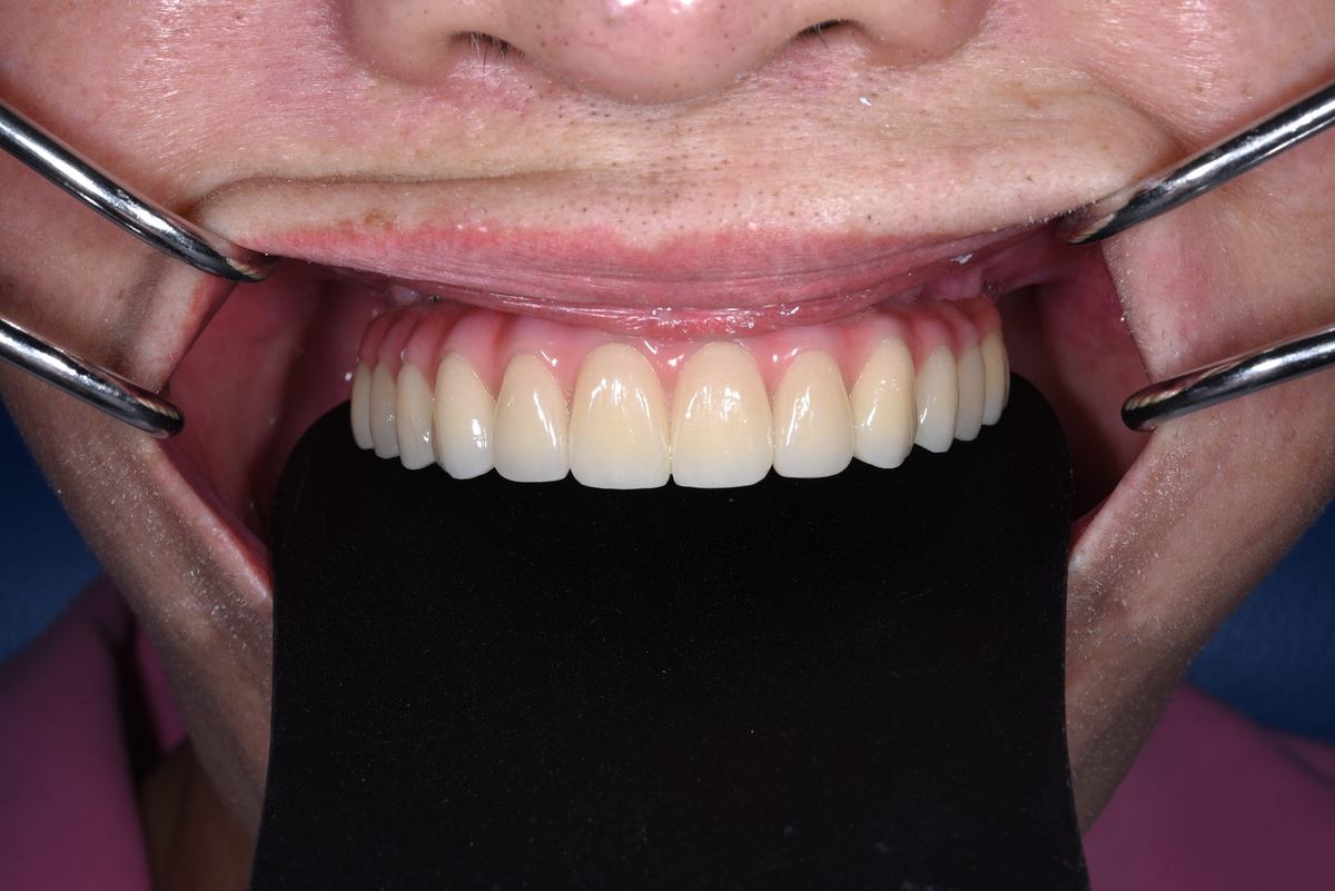 Hình: Cô Nguyễn Thị Ngọc Lan – quá trình điều trị