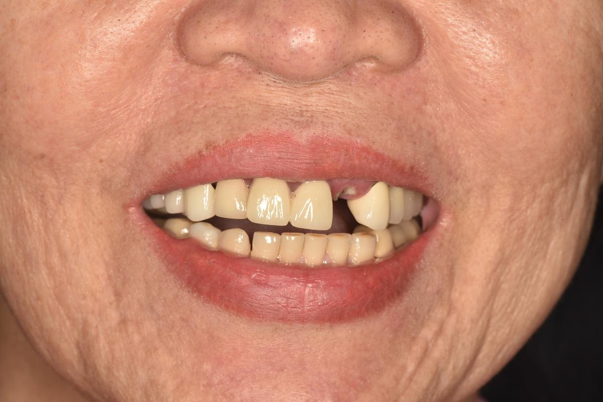 Hình: Cô Nguyễn Thị Ngọc Lan – tình trạng trước điều trị