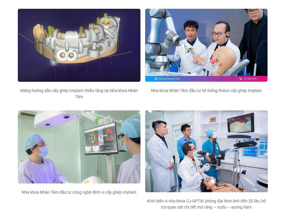 Hình: Công nghệ hỗ trợ cấy ghép Implant tại Nha khoa Nhân Tâm