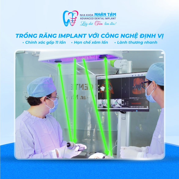 Công nghệ hỗ trợ quá trình cấy ghép implant