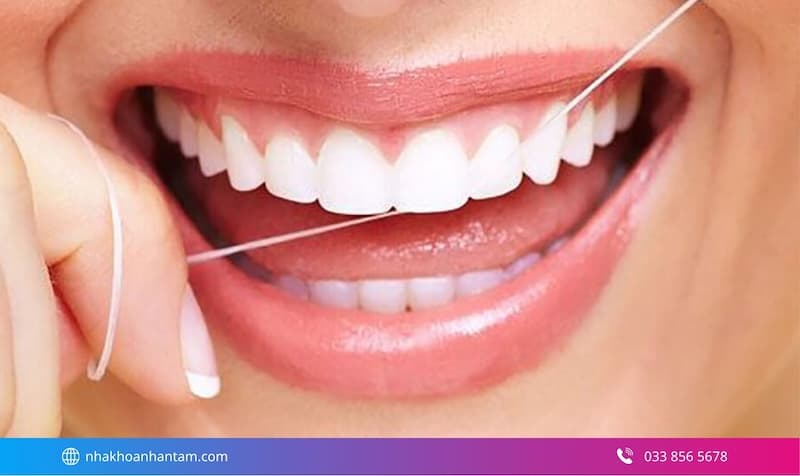 mặt dán sứ cho 2 răng cửa