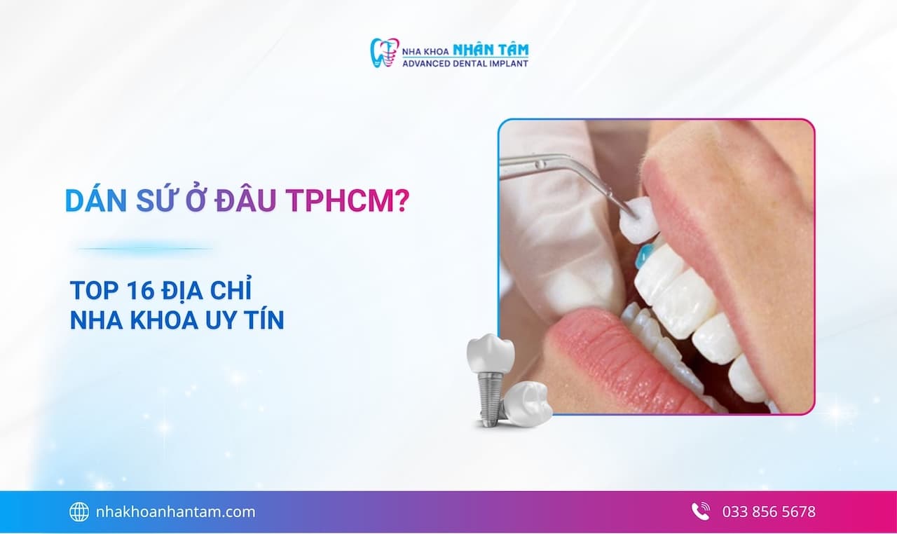 Dán sứ ở đâu TPHCM? Top 16 địa chỉ nha khoa uy tín Hình: Dán sứ ở đâu TPHCM? Top 16 địa chỉ nha khoa uy tín