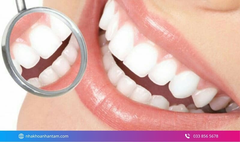 dán răng sứ emax