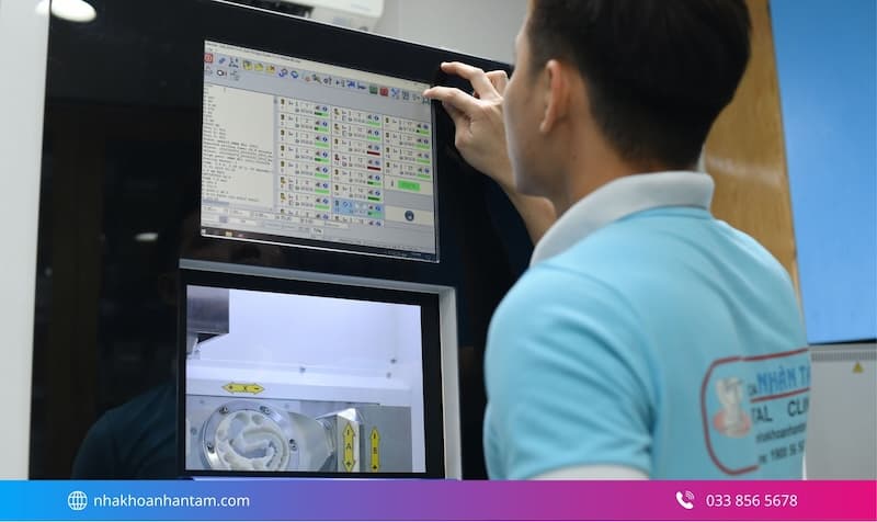 mặt dán sứ emax