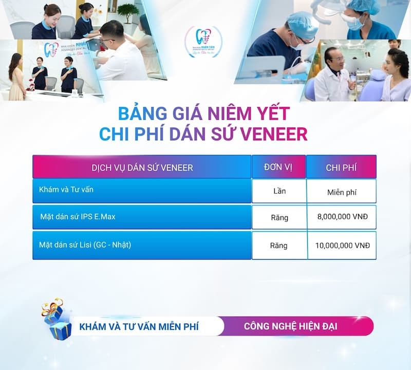 bảng giá mặt dán sứ veneer