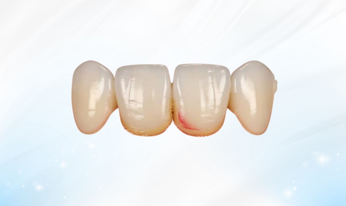 Nhận biết sớm các dấu hiệu bất thường giúp ngăn ngừa biến chứng nhiễm trùng lan rộng Hình: Nhận biết sớm các dấu hiệu bất thường giúp ngăn ngừa biến chứng nhiễm trùng lan rộng