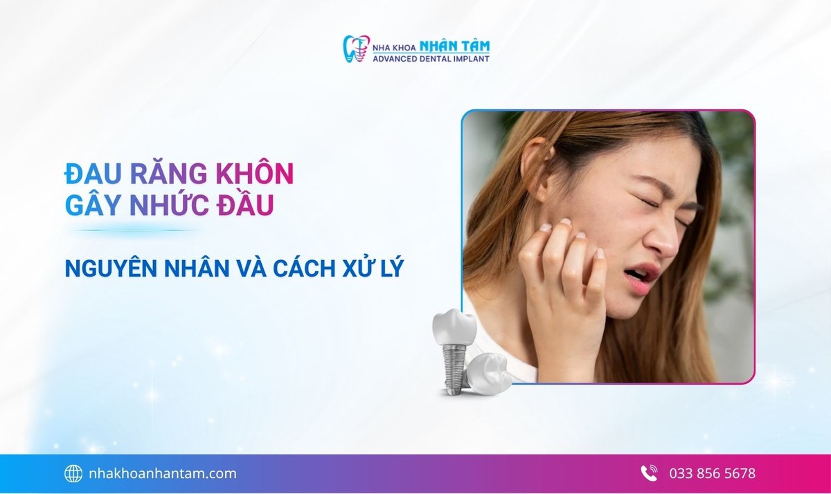 Đau răng khôn gây nhức đầu có nguy hiểm không? Nguyên nhân và cách xử lý