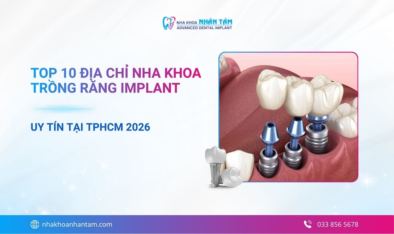 Top 10 Địa chỉ nha khoa trồng răng Implant tại TPHCM uy tín 2026 Hình: Top 10 Địa chỉ nha khoa trồng răng Implant tại TPHCM uy tín 2026