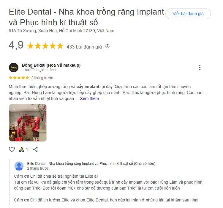 Hình: review trồng răng implant Elite Dental