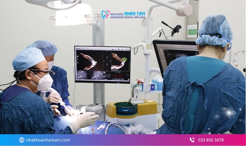 giá trồng răng implant all on 4