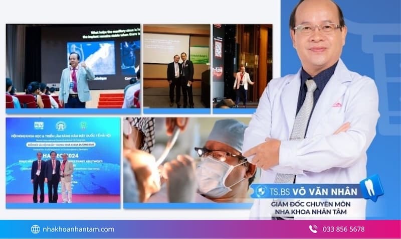implant có đáng tiền không