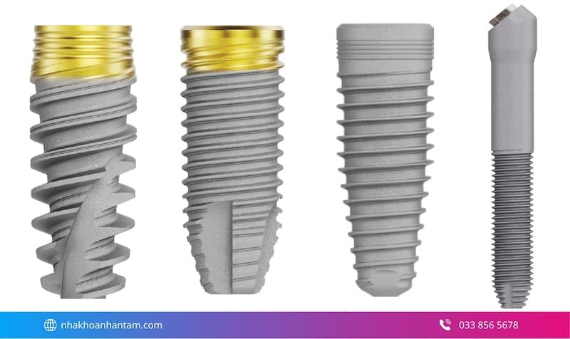 implant nobel là gì