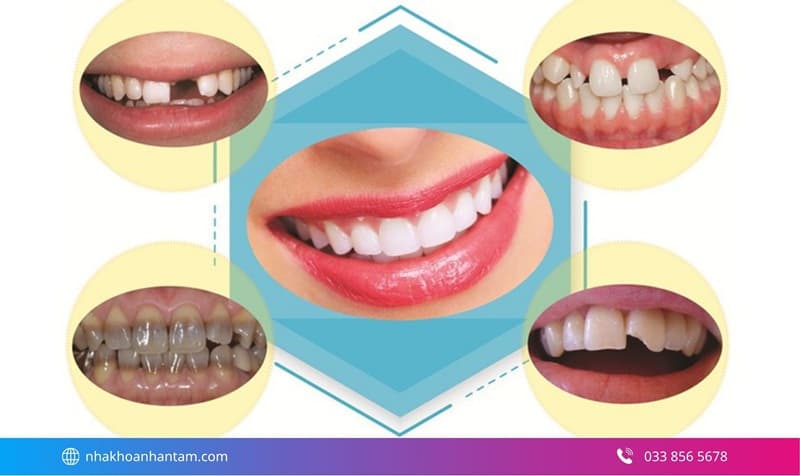 làm răng sứ thẩm mỹ