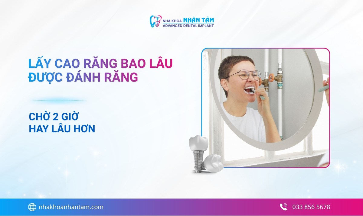 Lấy cao răng bao lâu được đánh răng? (Chờ 2 giờ hay lâu hơn?)