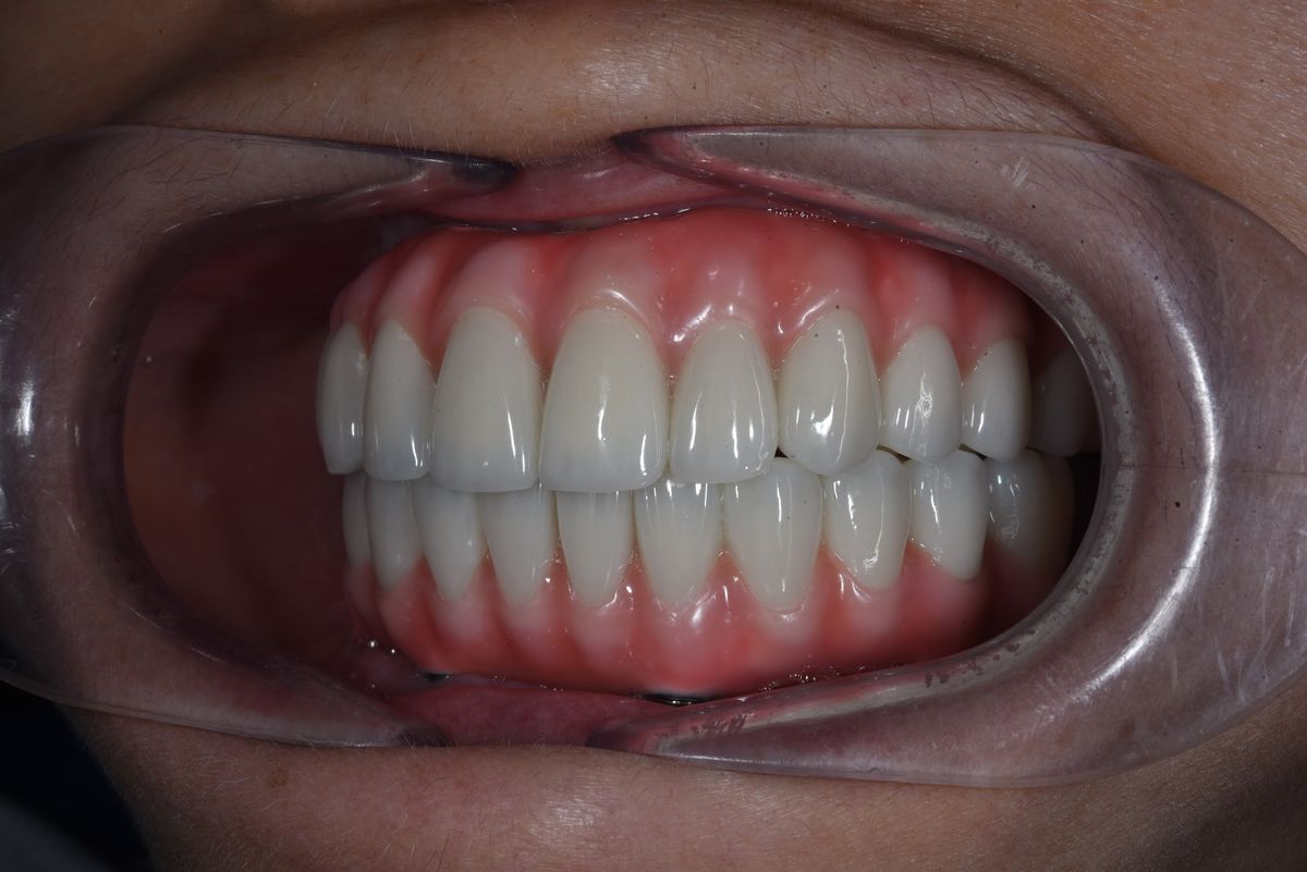Hình: Cô Nguyễn Thị Thanh Hoa – Câu chuyện khách hàng tại Nha khoa Nhân Tâm