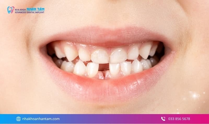 mất răng có nguy hiểm không