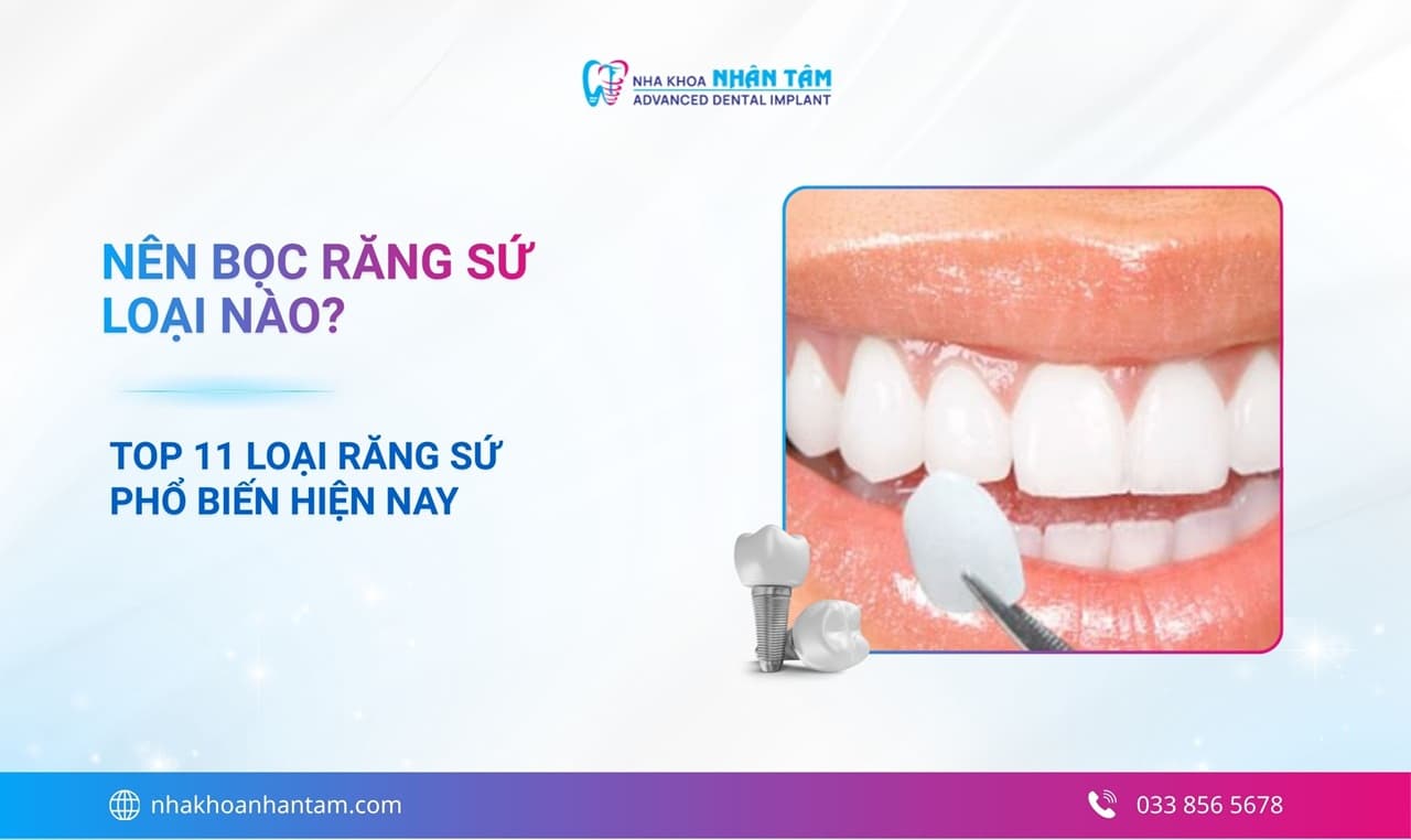 Hình: Nên bọc răng sứ loại nào? So sánh ưu và nhược điểm