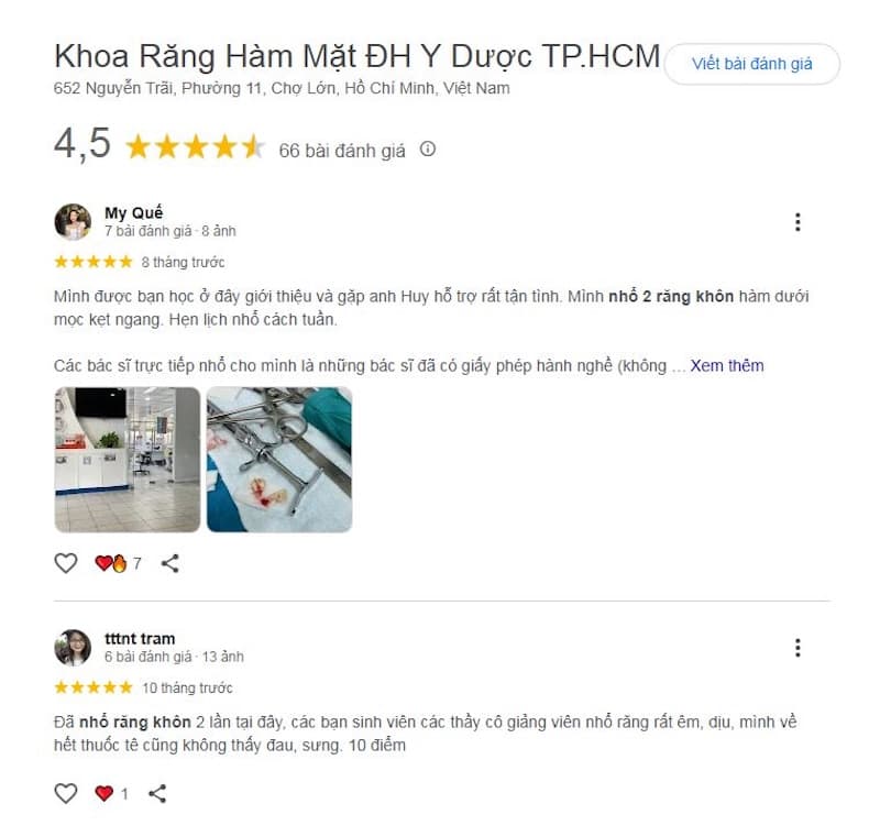 nha khoa nhổ răng khôn an toàn không đau
