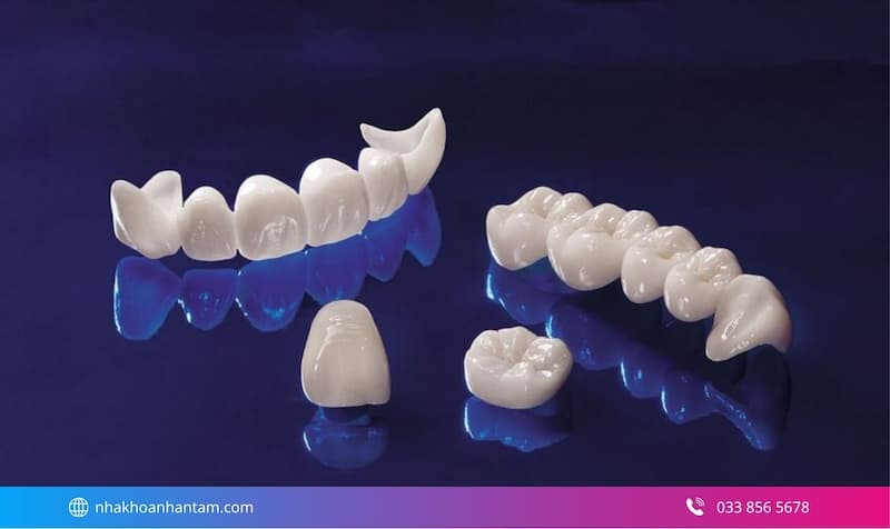 nha khoa răng sứ có labo tại chỗ