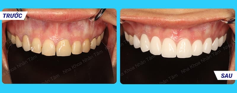 nha khoa thẩm mỹ răng sứ dịch vụ cao cấp