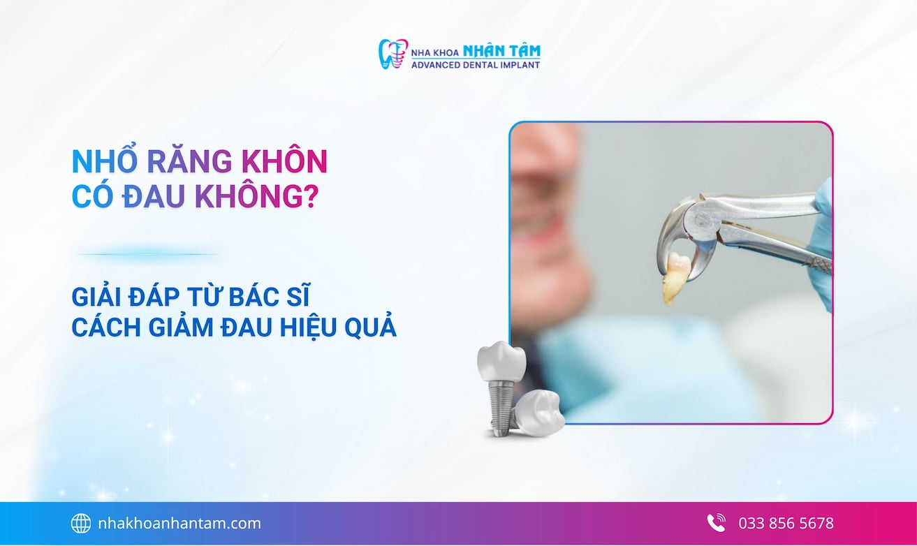 Nhổ răng khôn có đau không? Giải đáp từ bác sĩ và cách giảm đau hiệu quả
