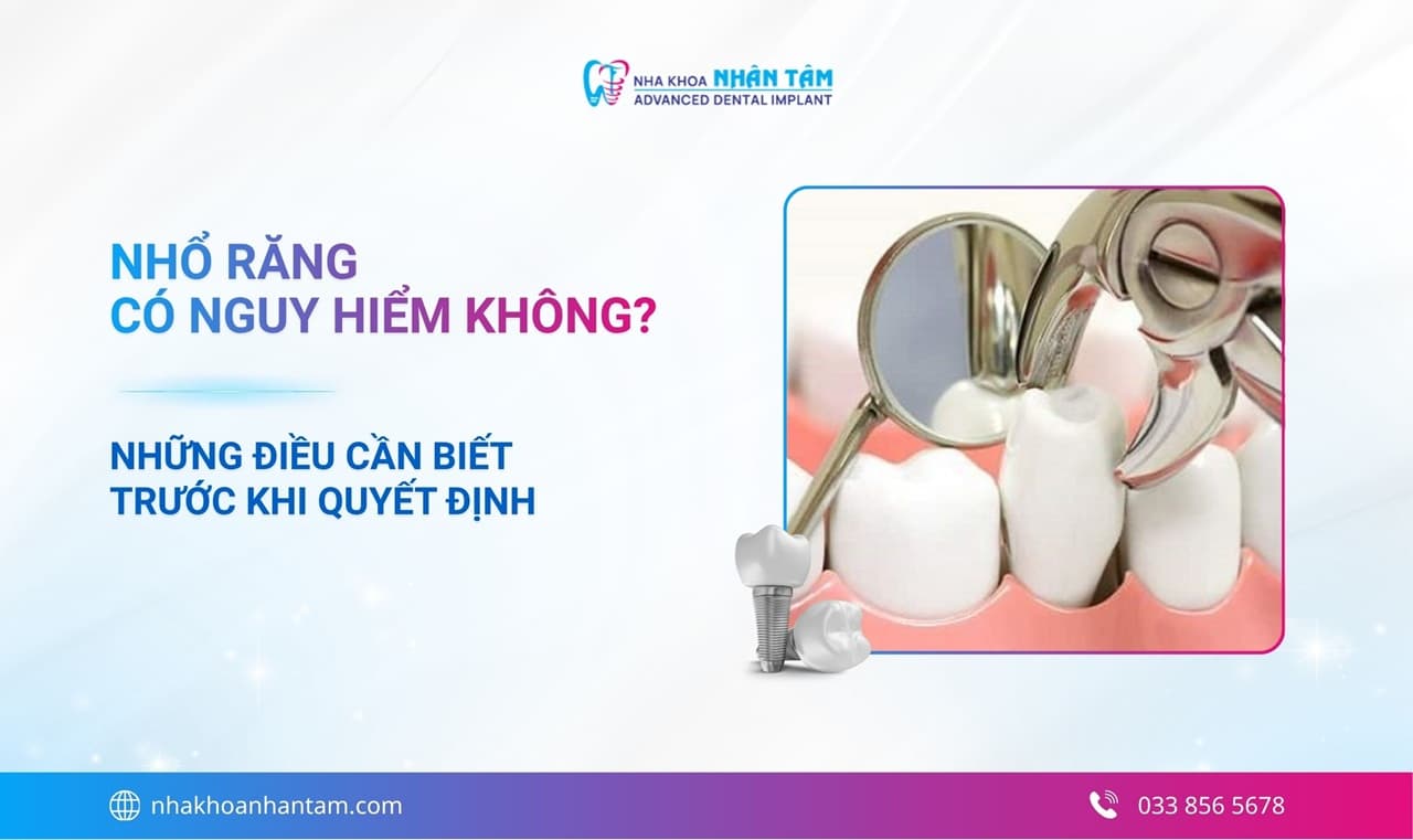 Hình: Nhổ răng có nguy hiểm không? Những điều bạn cần biết trước khi quyết định