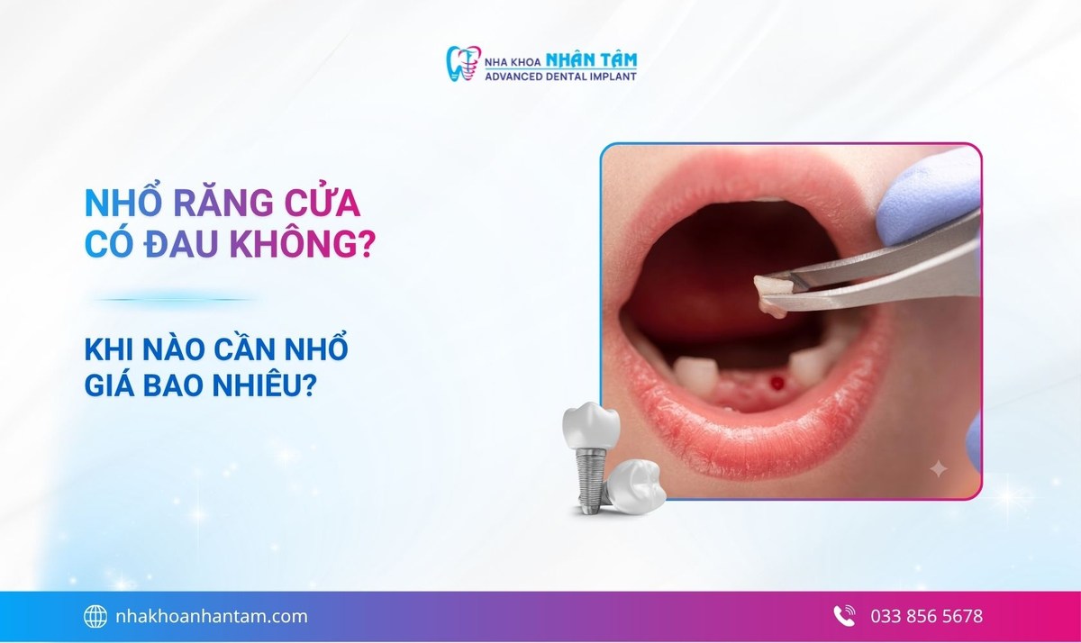 Nhổ răng cửa có đau không? Khi nào cần nhổ, giá bao nhiêu?