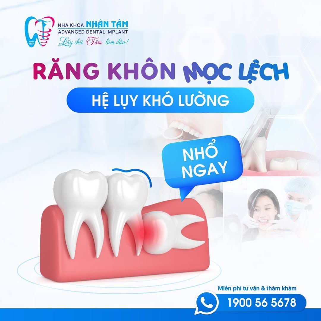 Hình: Hãy nhổ răng khôn ngay để bảo vệ sức khỏe răng miệng toàn diện và hạn chế tình trạng đau kéo dài