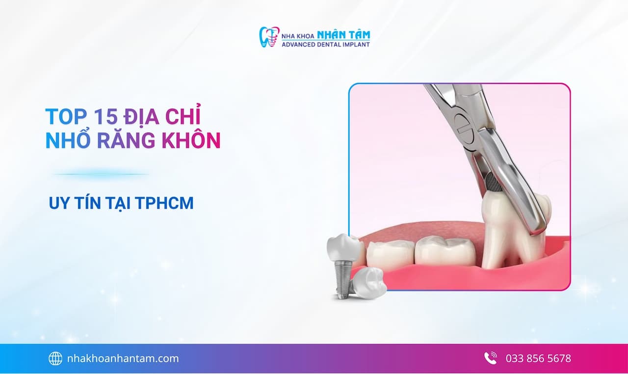 Hình: Top 15 địa chỉ nhổ răng khôn uy tín tại TPHCM