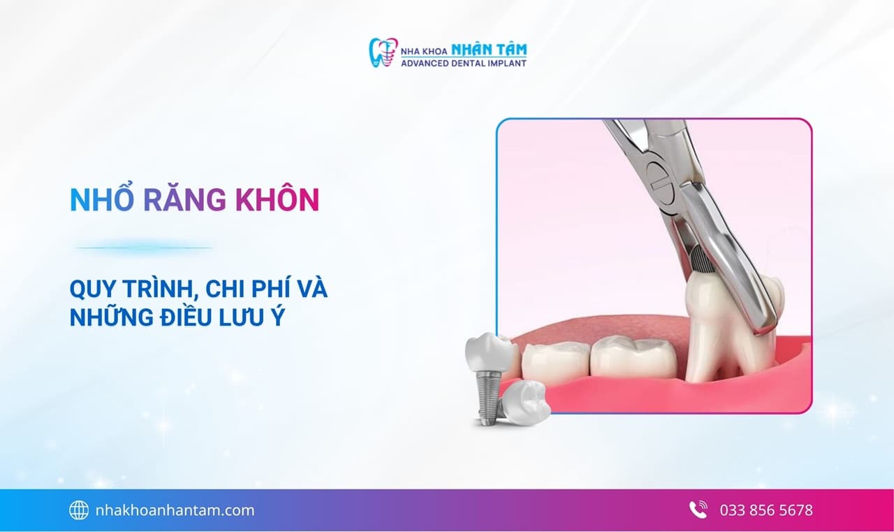 Hình: Nhổ răng khôn: Quy trình, chi phí và những điều cần lưu ý