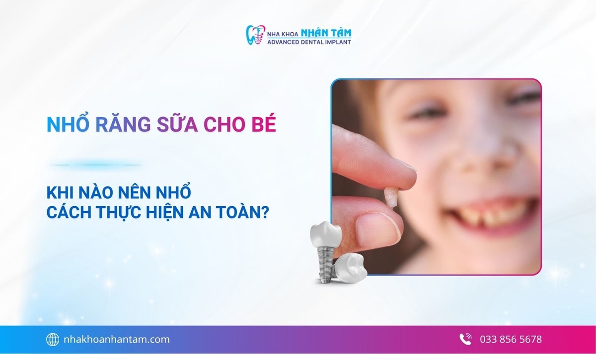 Nhổ răng sữa cho bé: Khi nào nên nhổ và cách thực hiện an toàn? 