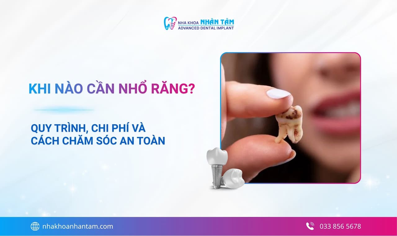 Nhổ răng: Khi nào cần nhổ? Quy trình, chi phí và cách chăm sóc an toàn