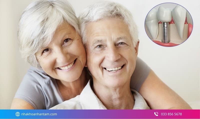 nhược điểm của trồng răng implant