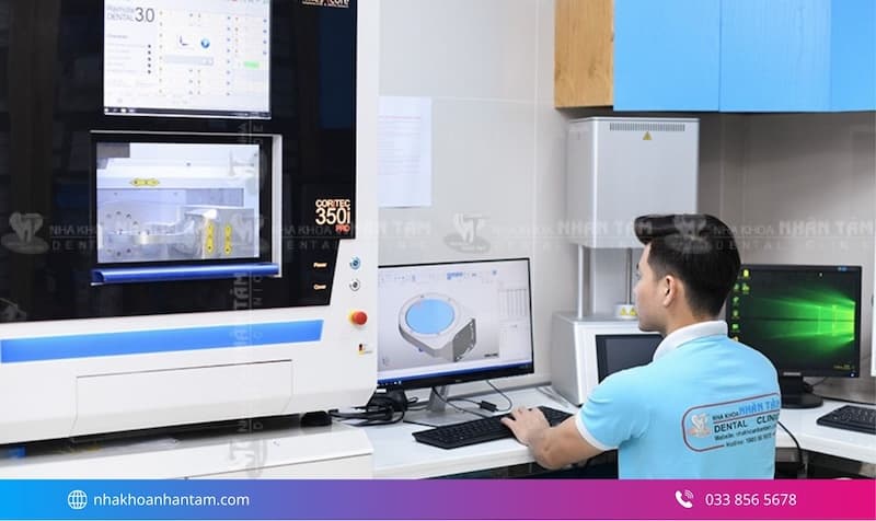 quy trình dán mặt sứ veneer