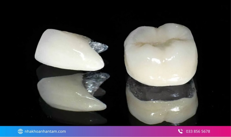 răng sứ nào tốt hơn kim loại hay toàn sứ
