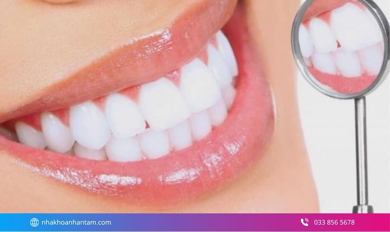 nhược điểm răng sứ lava
