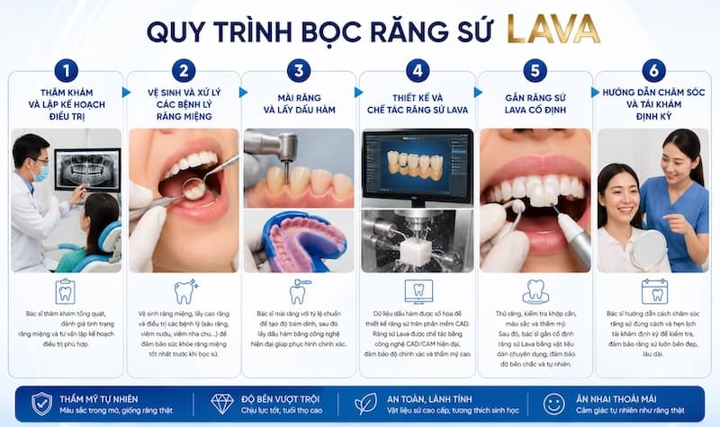 làm răng sứ lava