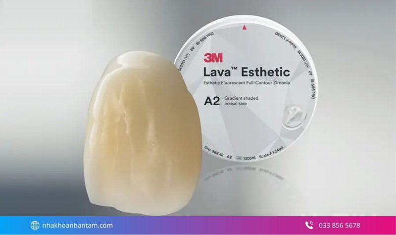 răng sứ nào có độ bền cao