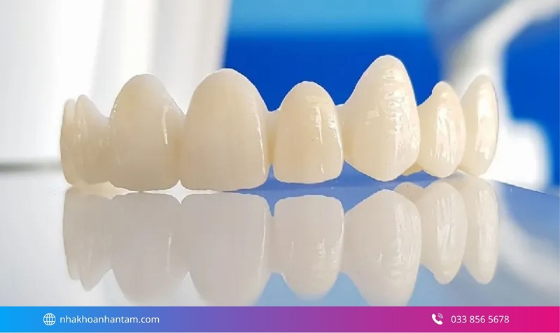 răng sứ nào đẹp và bền