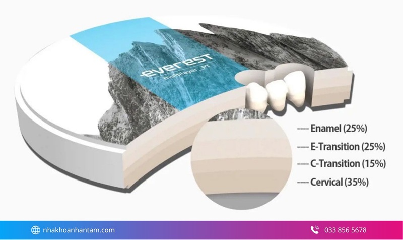 răng sứ nào tốt cho răng hàm