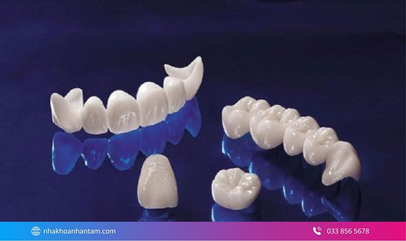 răng sứ nào tốt nhất hiện nay