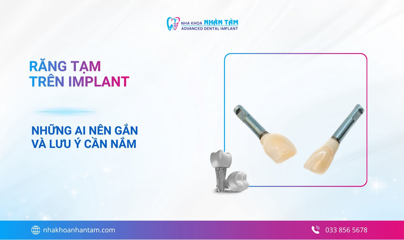 Gắn răng tạm trong cấy implant: Khi nào cần, quy trình và chi phí tại Nha khoa Nhân Tâm