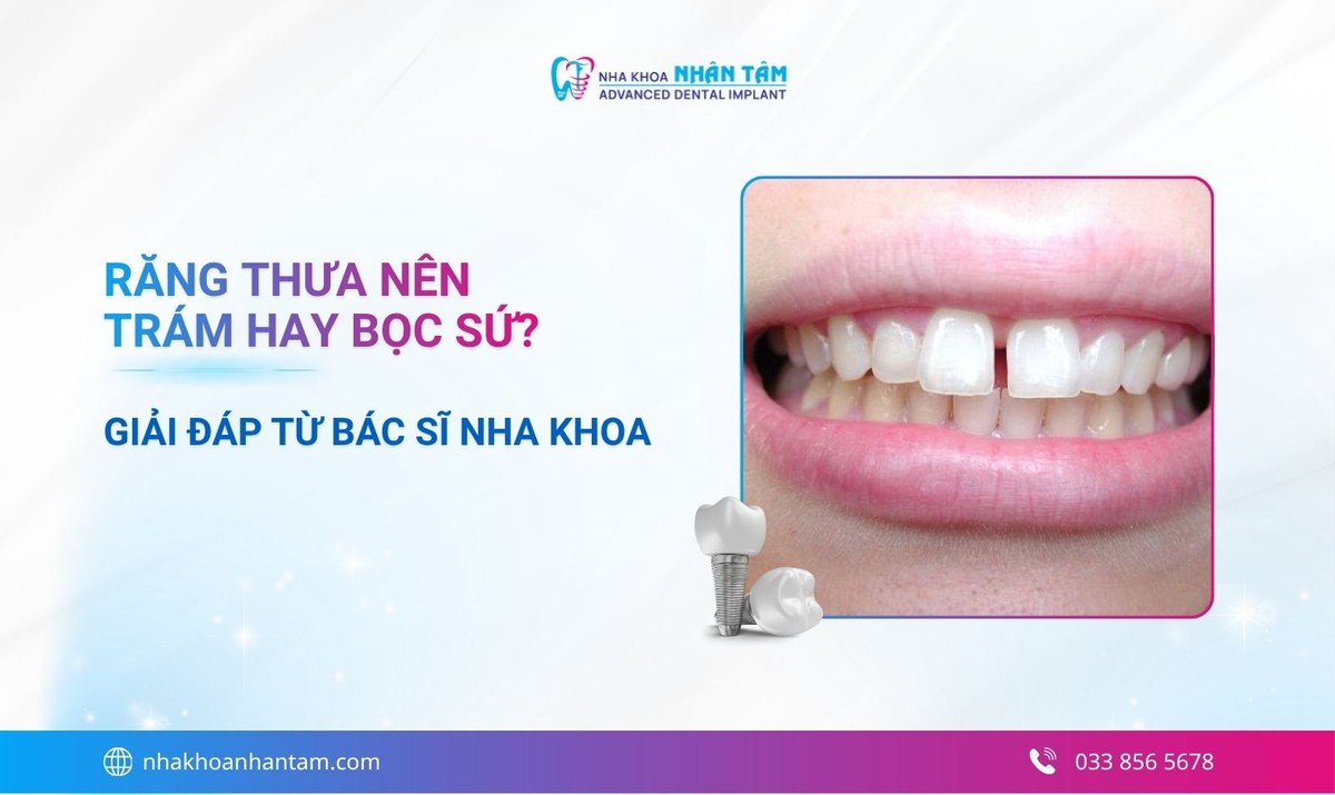 Răng thưa nên trám hay bọc sứ? Giải đáp từ bác sĩ nha khoa