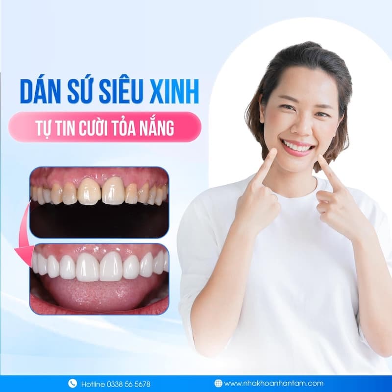 ý kiến khách hàng dán sứ