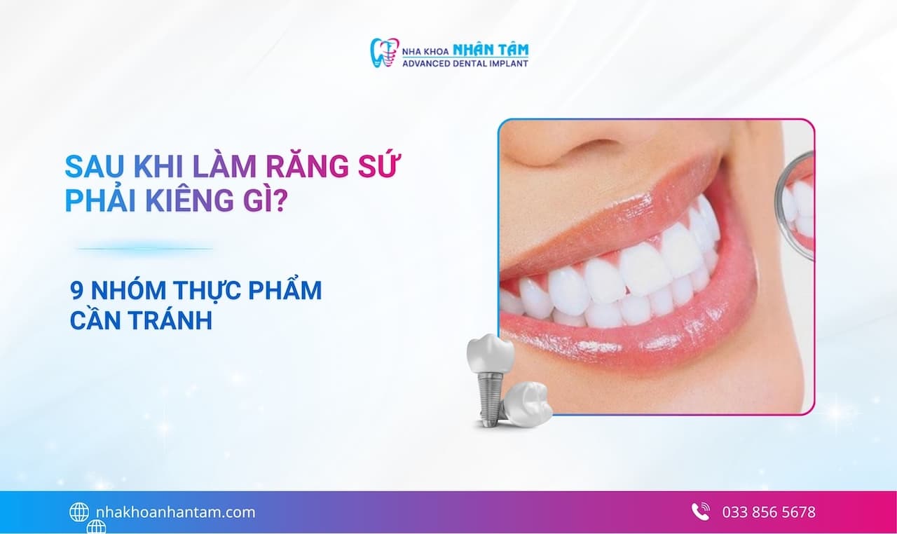 Sau khi làm răng sứ phải kiêng gì? 9 nhóm thực phẩm cần tránh