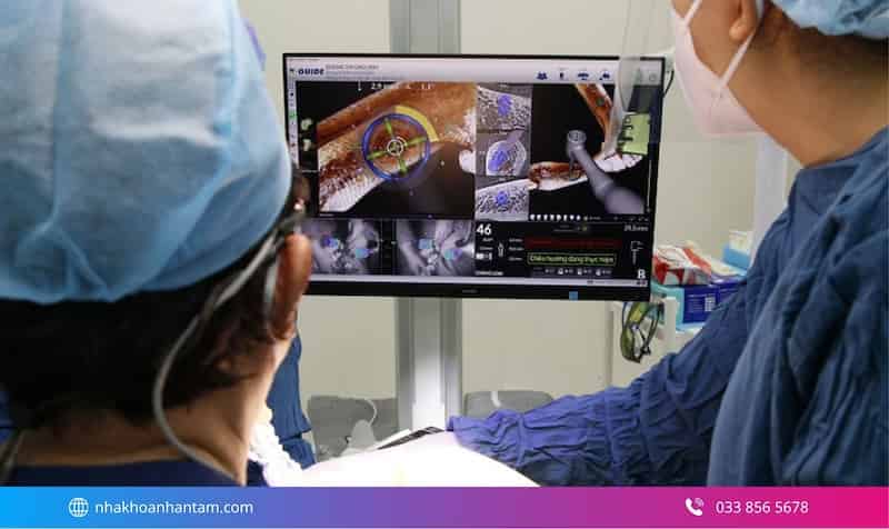 so sánh implant tức thì và truyền thống