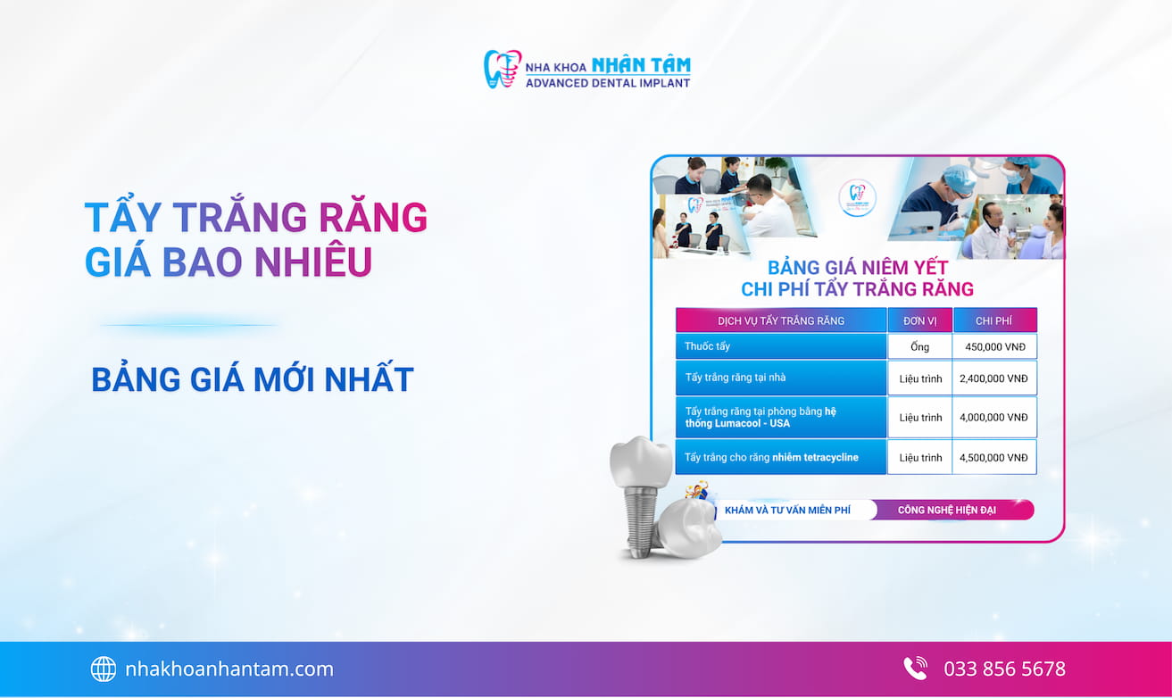 Tẩy trắng răng giá bao nhiêu tiền? Bảng giá mới nhất 2026