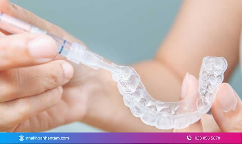tẩy trắng răng giá bao nhiêu