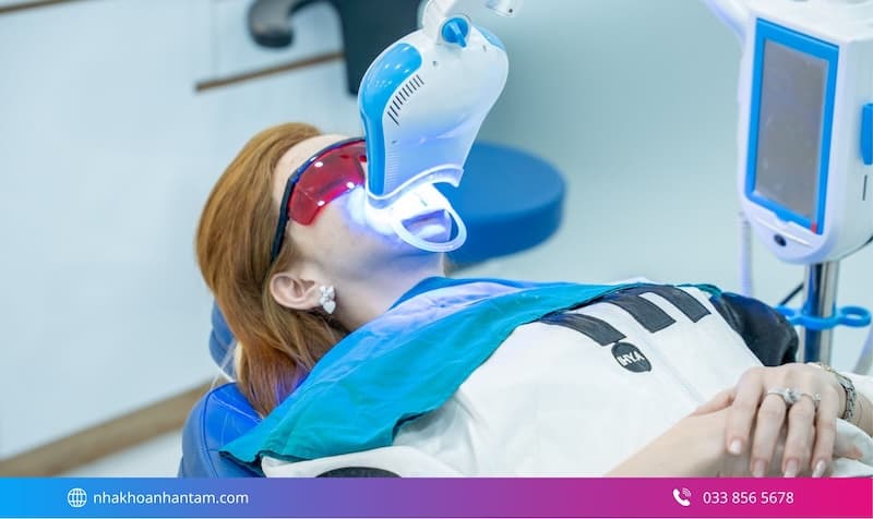 tẩy trắng răng thẩm mỹ