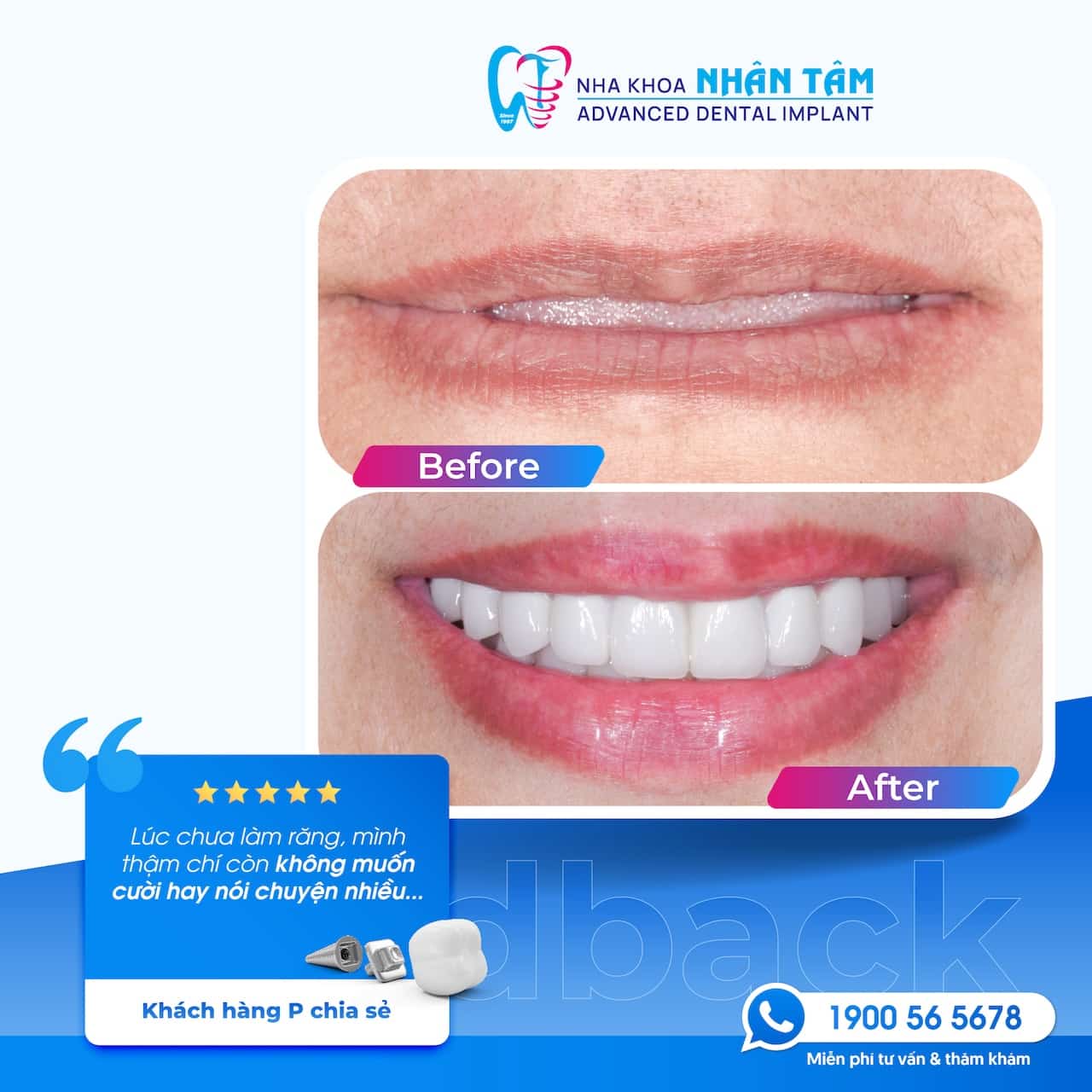 Thay đổi để thành công hơn, hãy bắt đầu từ nụ cười!